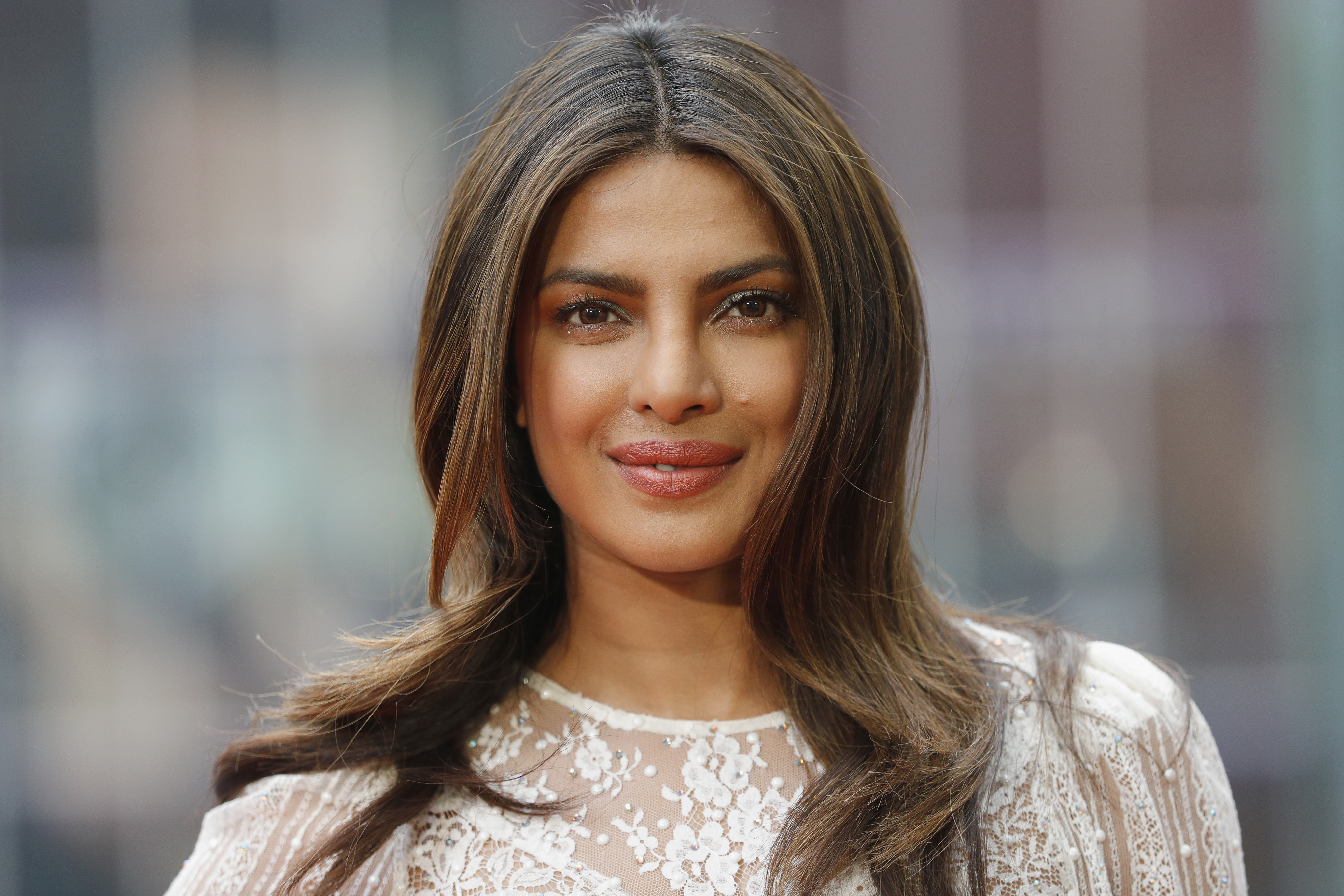 Citadel' Star Priyanka Chopra Jonas Reveals On-Set Injury