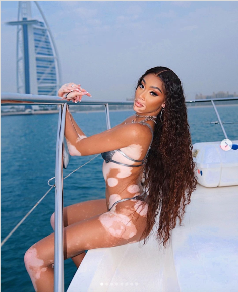 Winnie Harlow In Bikini “Brought Water” To Ibiza