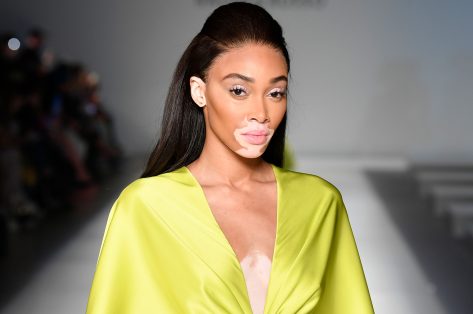 Winnie Harlow in Bathing Suit Says “I Love Your Smile”