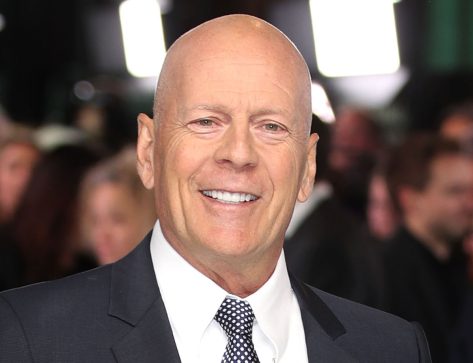 Signs You May Have Aphasia, Like Bruce Willis