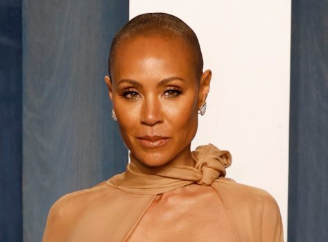 Jada Pinkett Smith’s Hair Loss is Caused by Alopecia