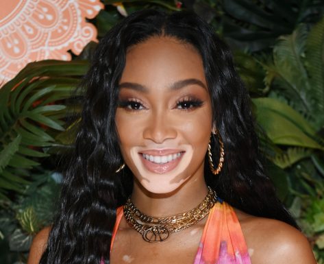 Winnie Harlow in Bathing Suit is “Glowy”